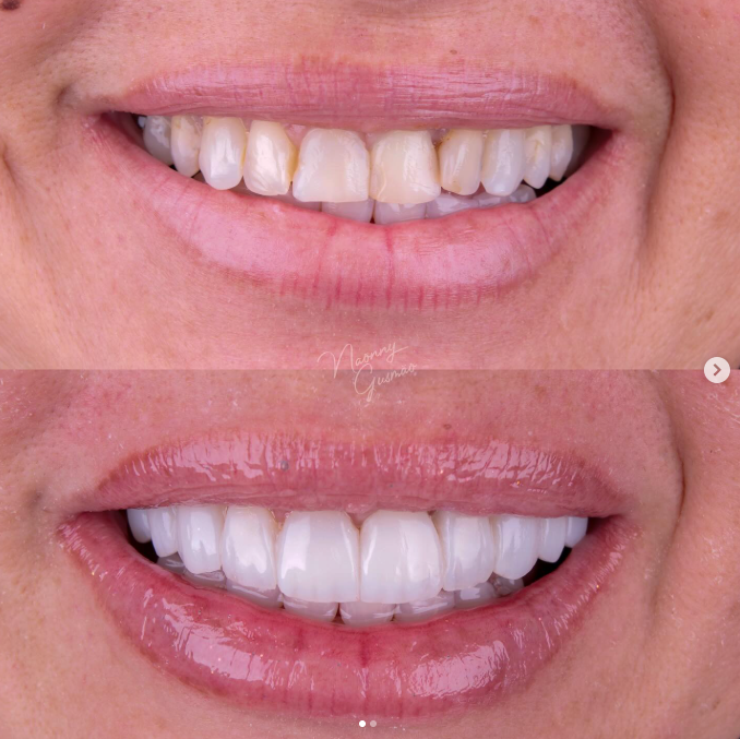 Resultado de tratamento odontológico