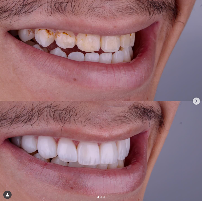 Resultado de tratamento odontológico